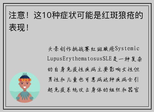 注意！这10种症状可能是红斑狼疮的表现！